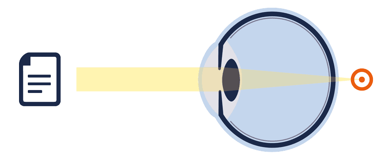 Ohne Lesebrille unscharfes Sehen im Alter